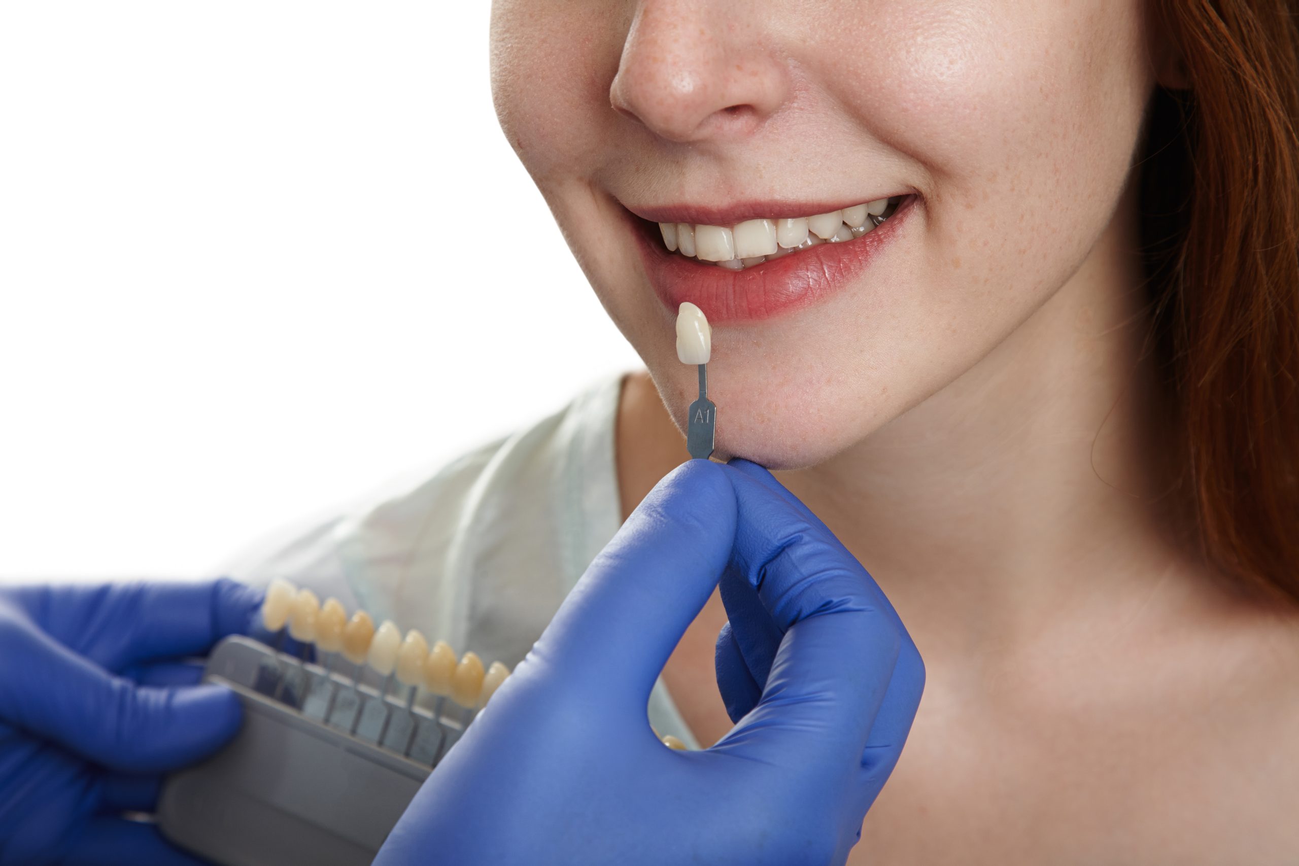 dental crowns near you