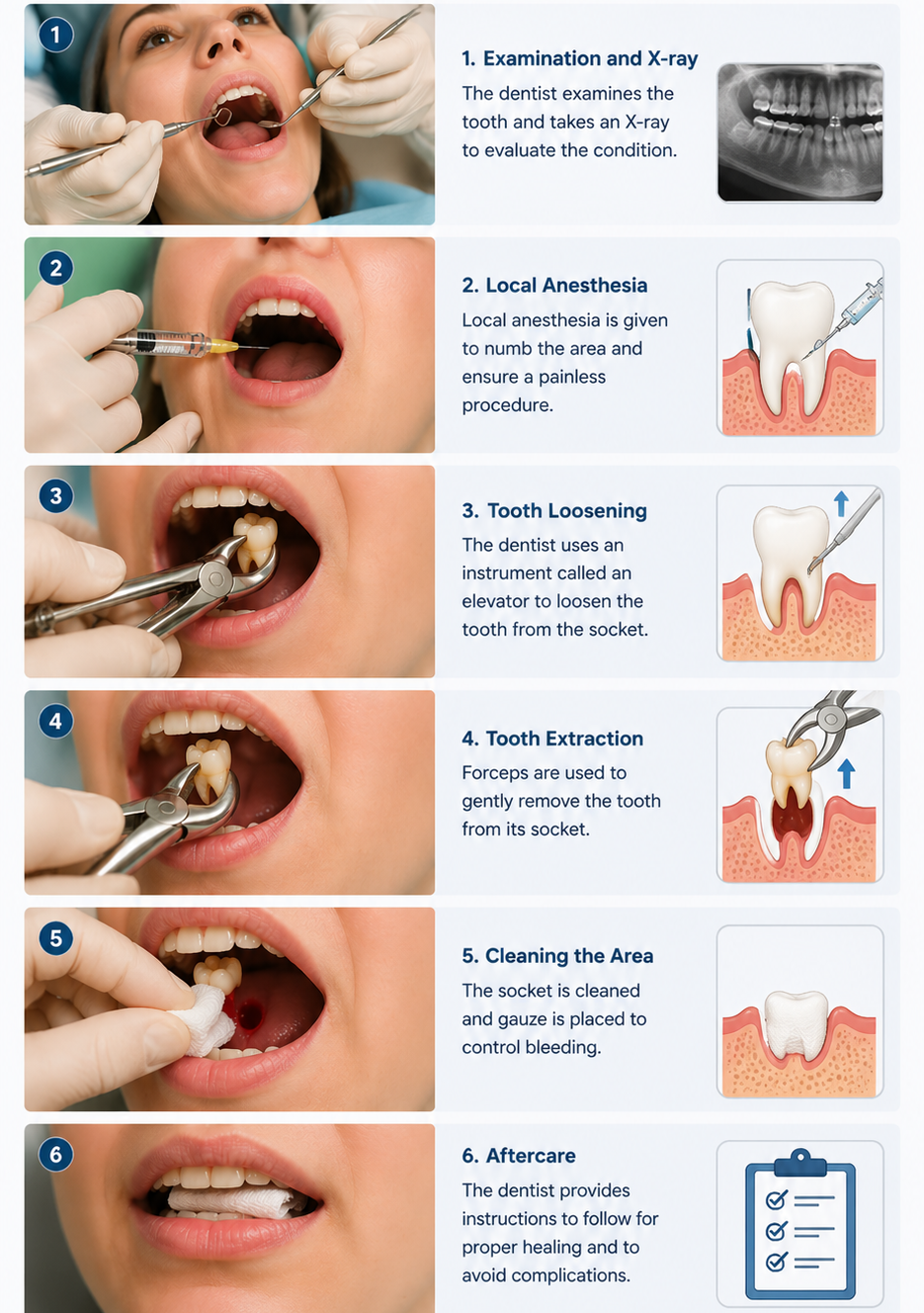 tooth extractions near you