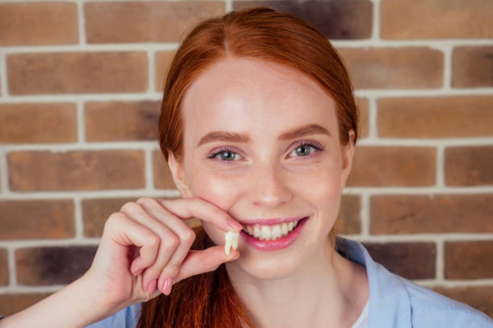 Wisdom Teeth Removal Recovery: How Long Does It Take and What to Expect